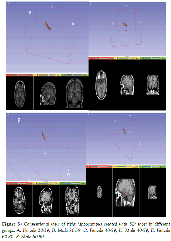 Anatomical-Variations-Conventional-view