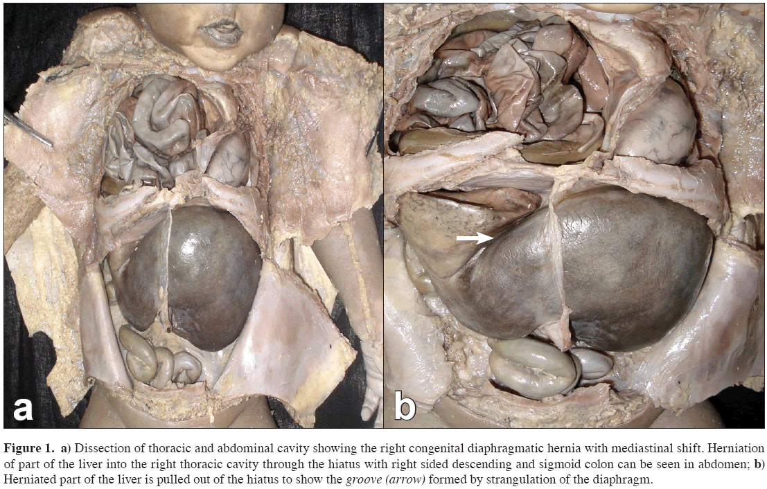 Anatomical-Variations-Dissection-thoracic-abdominal