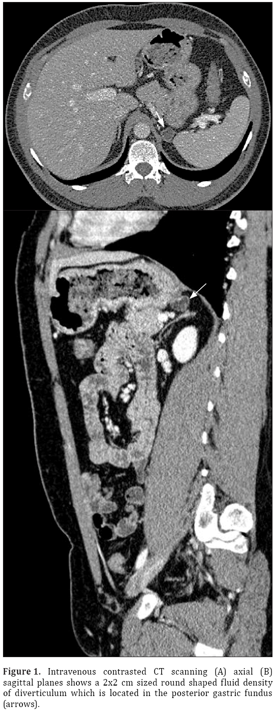 Anatomical-Variations-Intravenous-contrasted-CT