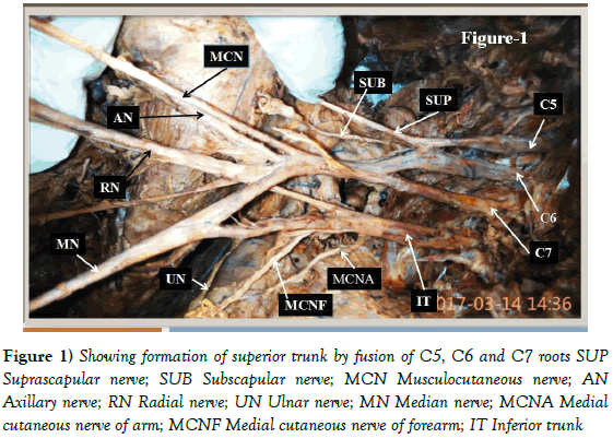 Anatomical-Variations-Medial-cutaneous-nerve