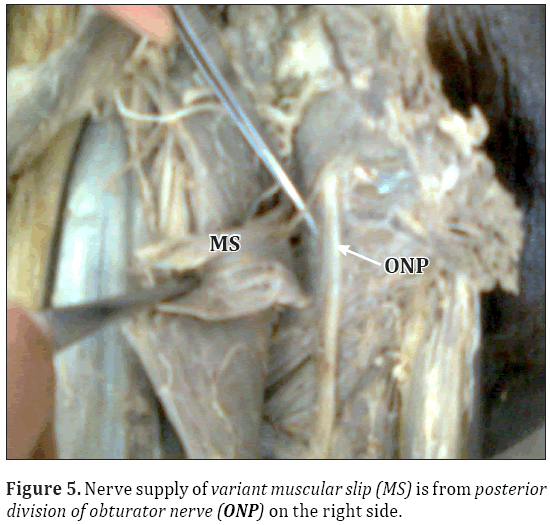 Anatomical-Variations-Nerve-supply-variant