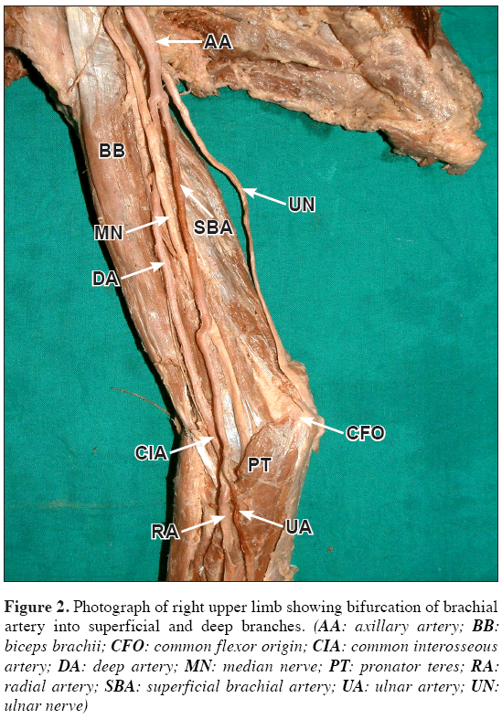 Anatomical-Variations-Photograph-right-upper-limb