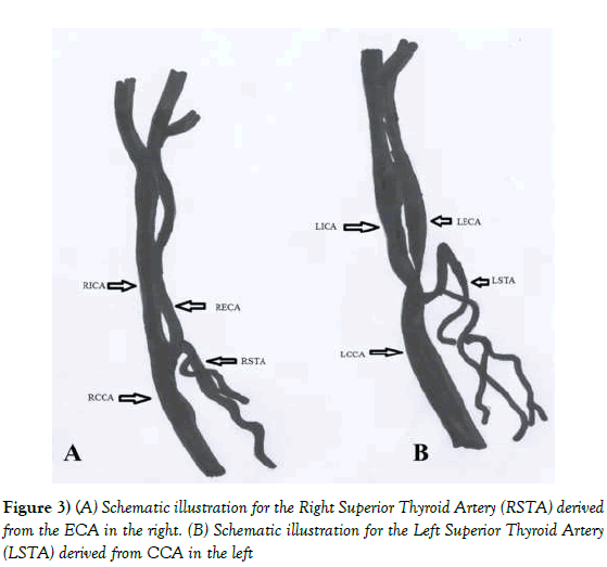 Anatomical-Variations-Schematic-illustration