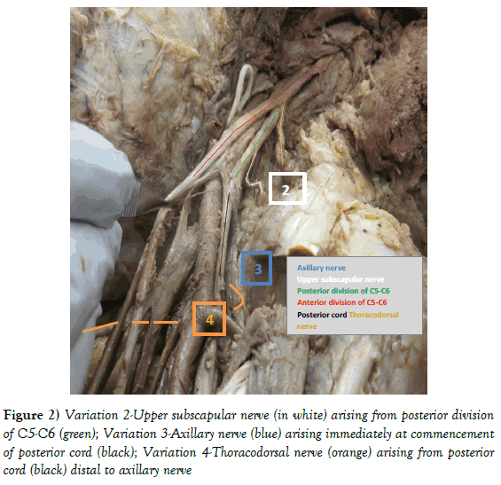 Anatomical-Variations-Upper-subscapular-nerve