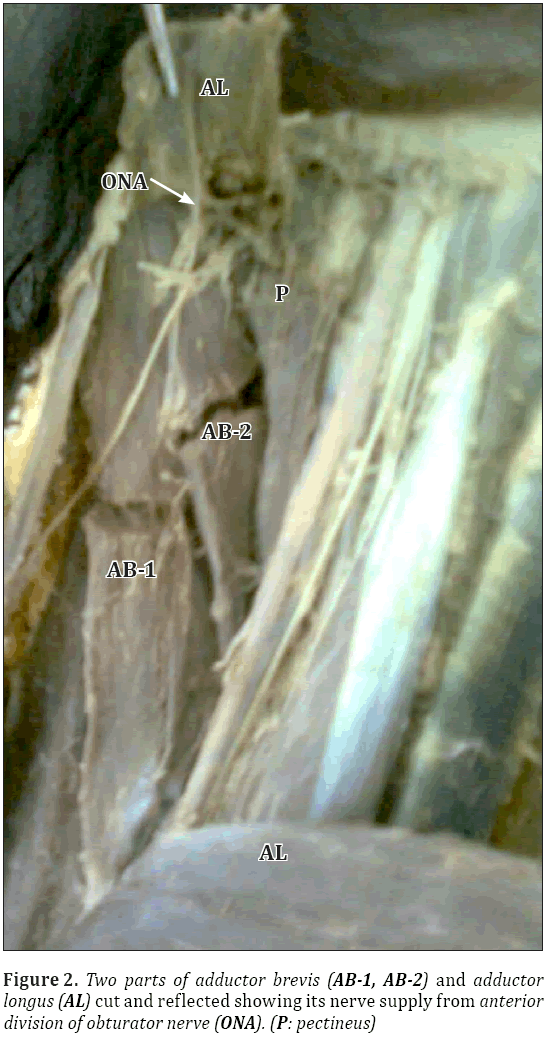 Anatomical-Variations-adductor-brevis