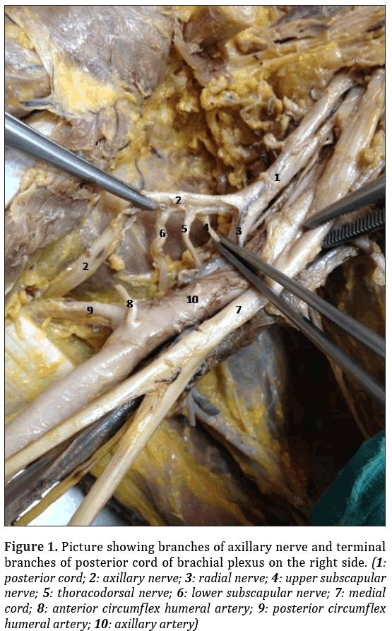 Anatomical-Variations-axillary-nerve-terminal