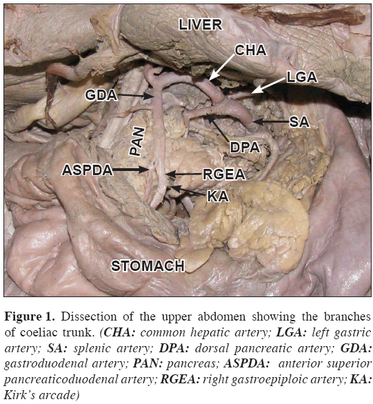 Anatomical-Variations-common-hepatic-artery