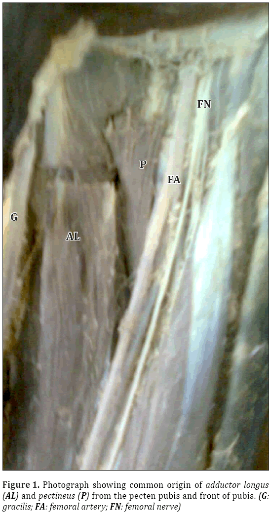 Anatomical-Variations-common-origin-adductor