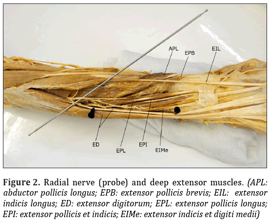 Anatomical-Variations-deep-extensor-muscles