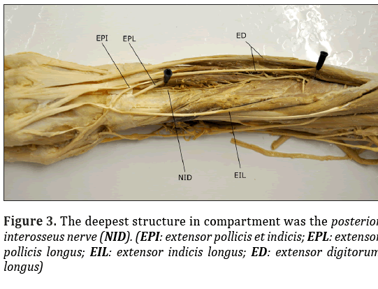 Anatomical-Variations-deepest-structure-compartment
