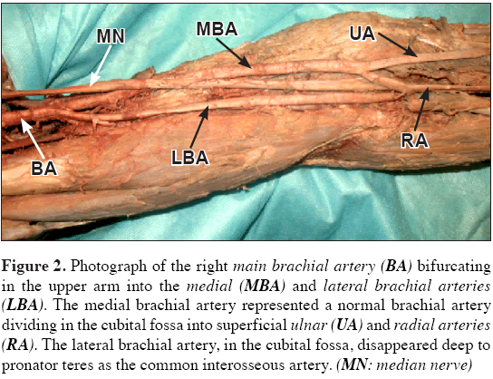 Anatomical-Variations-main-brachial-artery