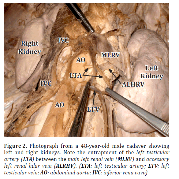 Anatomical-Variations-male-cadaver