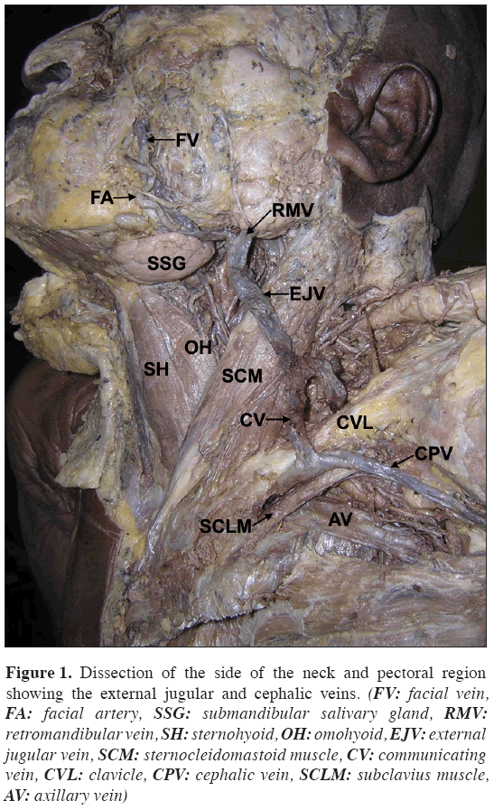 Anatomical-Variations-neck-pectoral-region