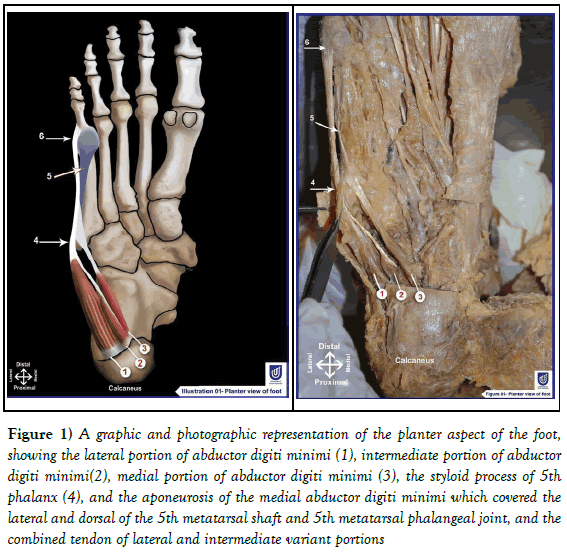 Anatomical-Variations-planter-aspect-foot