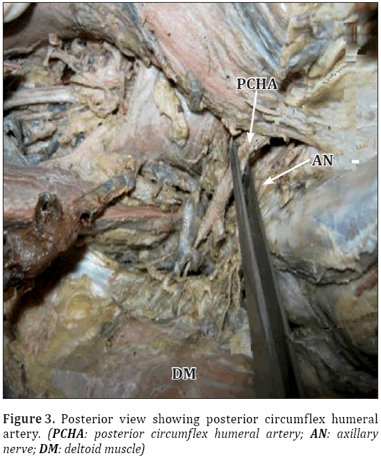 Anatomical-Variations-posterior-circumflex-humeral