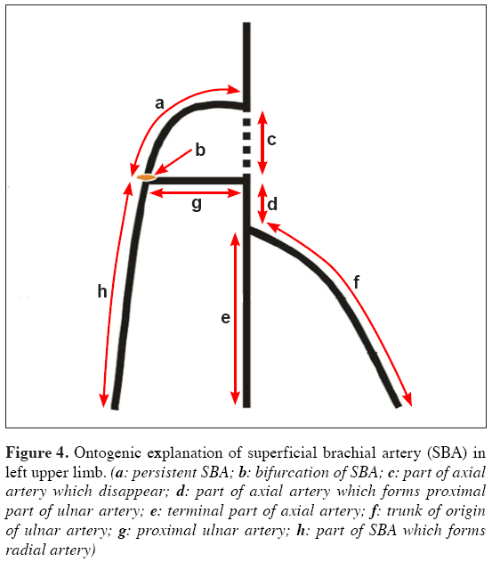 Anatomical-Variations-proximal-ulnar-artery