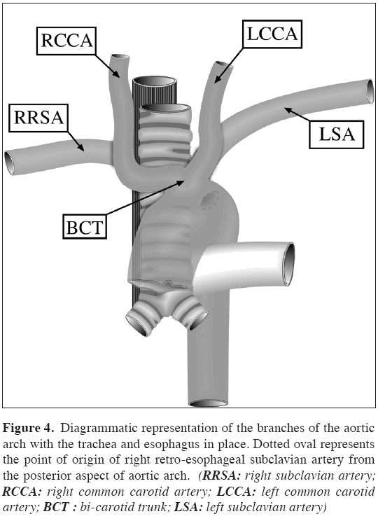 Anatomical-Variations-right-common-carotid