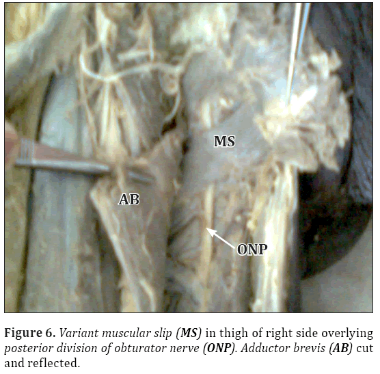 Anatomical-Variations-right-side-overlying