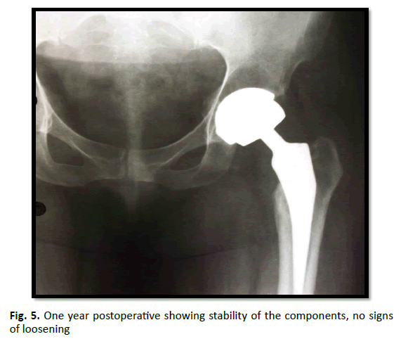 Orthopaedics-Trauma-Surgery-One-year