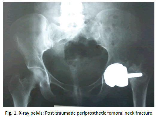 Orthopaedics-Trauma-Surgery-Post-traumatic