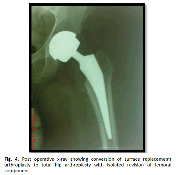 Orthopaedics-Trauma-Surgery-arthroplasty