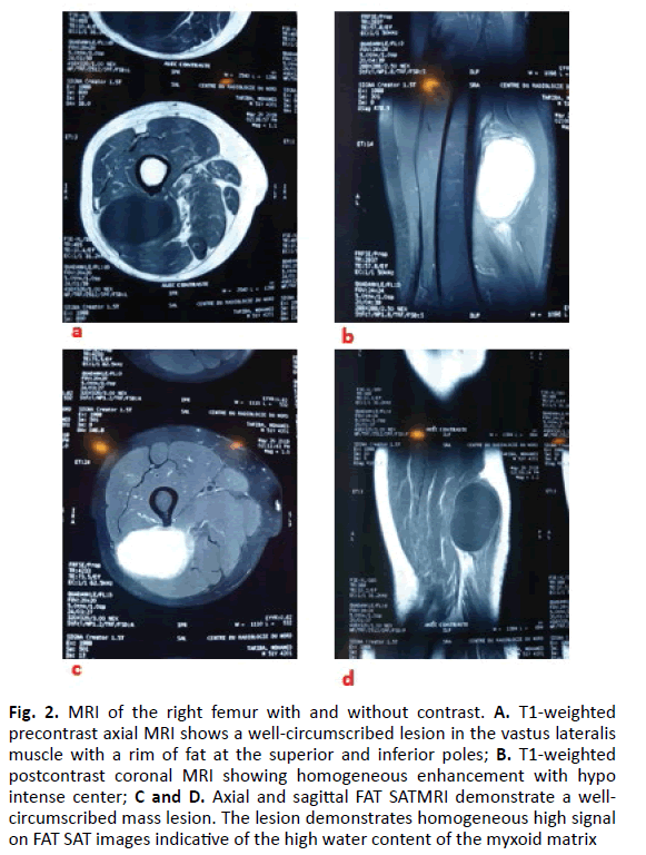 Orthopaedics-Trauma-Surgery-right-femur