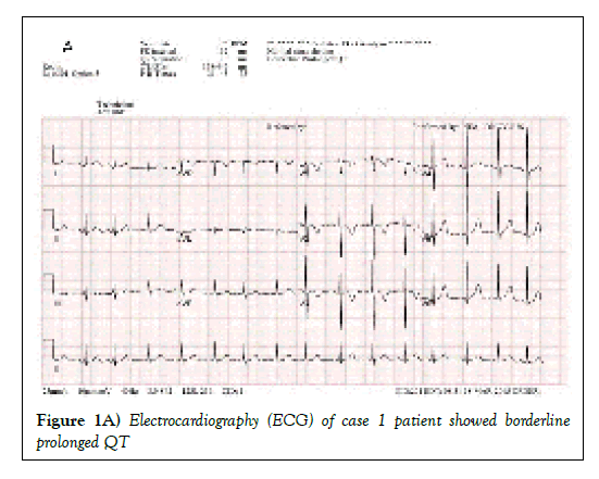 Pedia-Health-Care-Electrocardiography