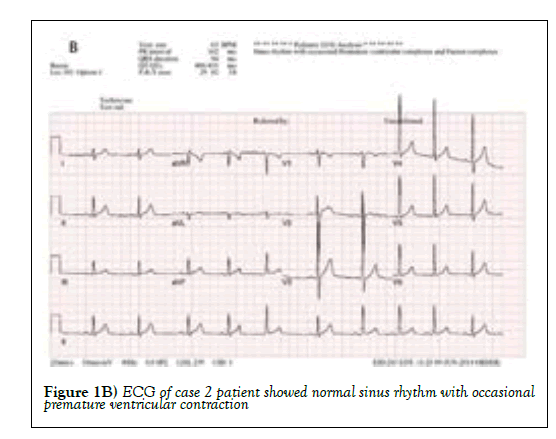 Pedia-Health-Care-sinus-rhythm