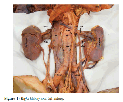 anatomical-kidney