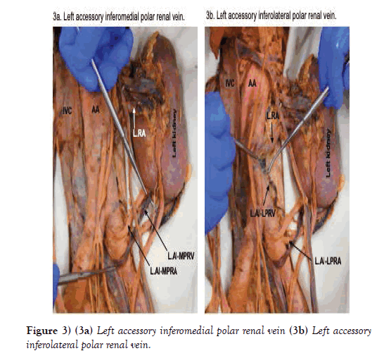 anatomical-polar-renal