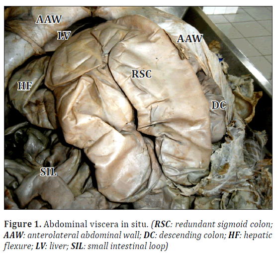 bulls have sigmoid flexture bulls have sigmoid flexture
