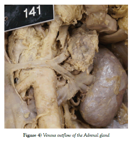 anatomical-variations-Adrenal-gland