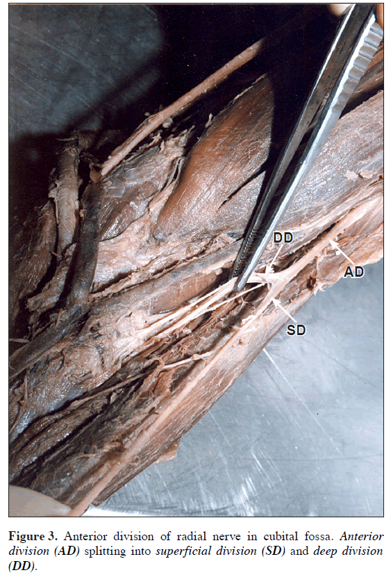 anatomical-variations-Anterior-division