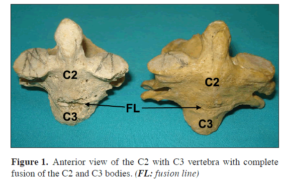 anatomical-variations-Anterior-view