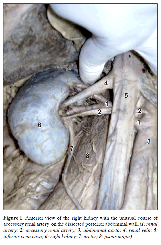 anatomical-variations-Anterior-view