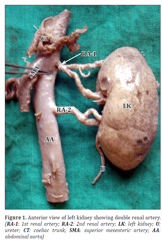 anatomical-variations-Anterior-view