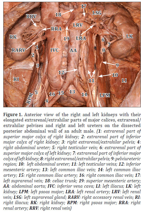 anatomical-variations-Anterior-view