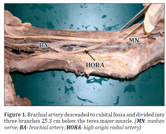anatomical-variations-Brachial-artery