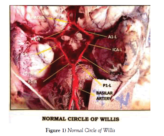 Circulus arteriosus willisii