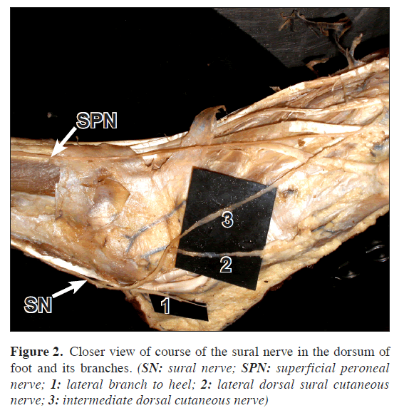 anatomical-variations-Closer-view