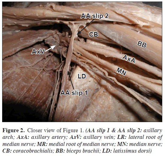 anatomical-variations-Closer-view