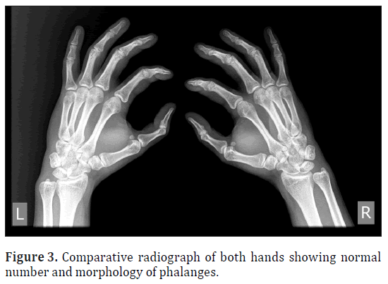 anatomical-variations-Comparative-morphology