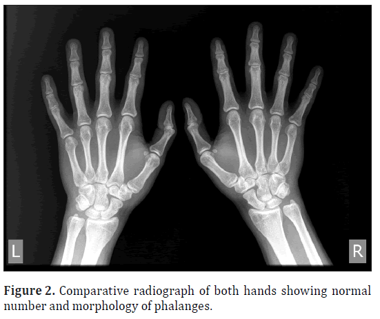 anatomical-variations-Comparative-radiograph