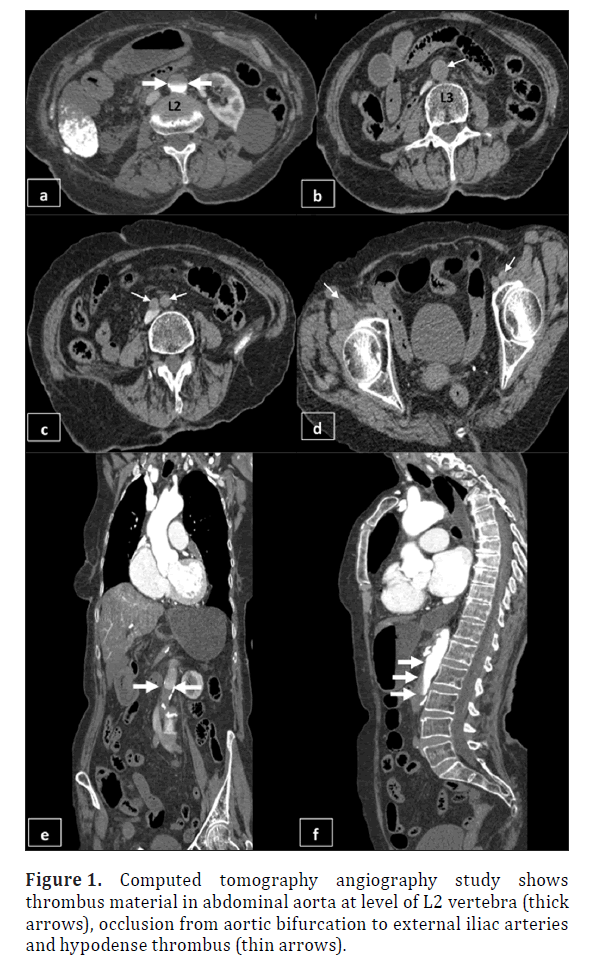 anatomical-variations-Computed-tomography-9-057-g001