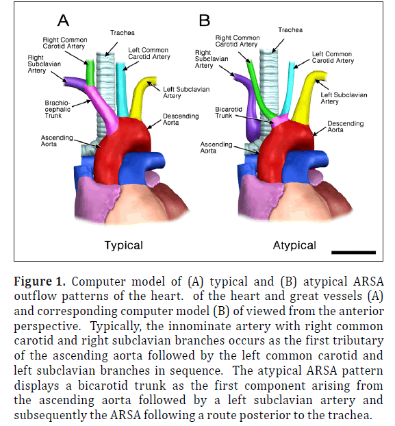 anatomical-variations-Computer-model