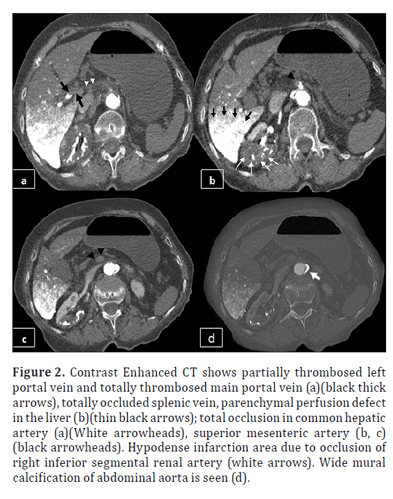 anatomical-variations-Contrast-Enhanced