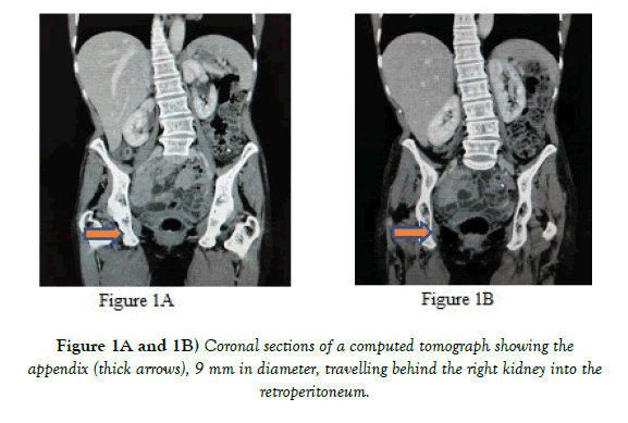 anatomical-variations-Coronal-sections