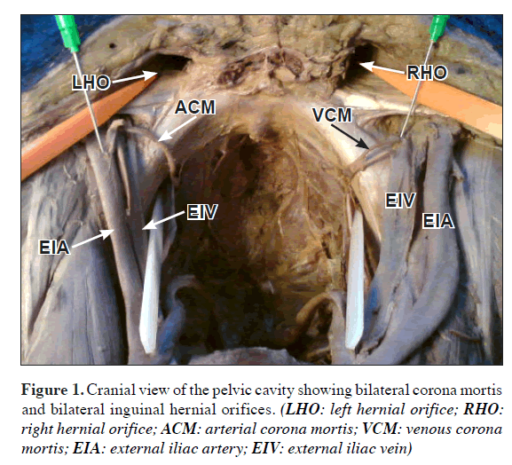 anatomical-variations-Cranial-view