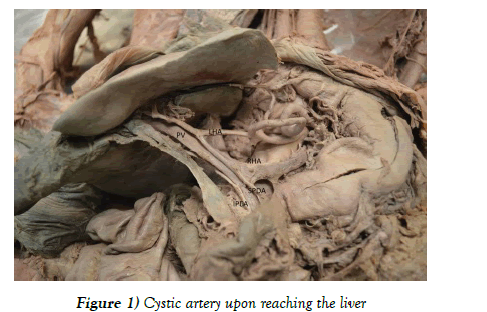 anatomical-variations-Cystic-liver