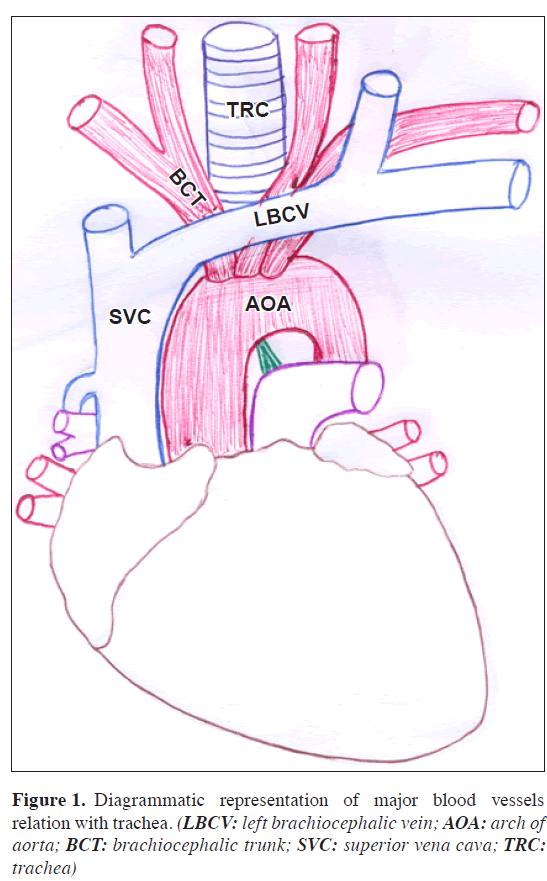 anatomical-variations-Diagrammatic-representation